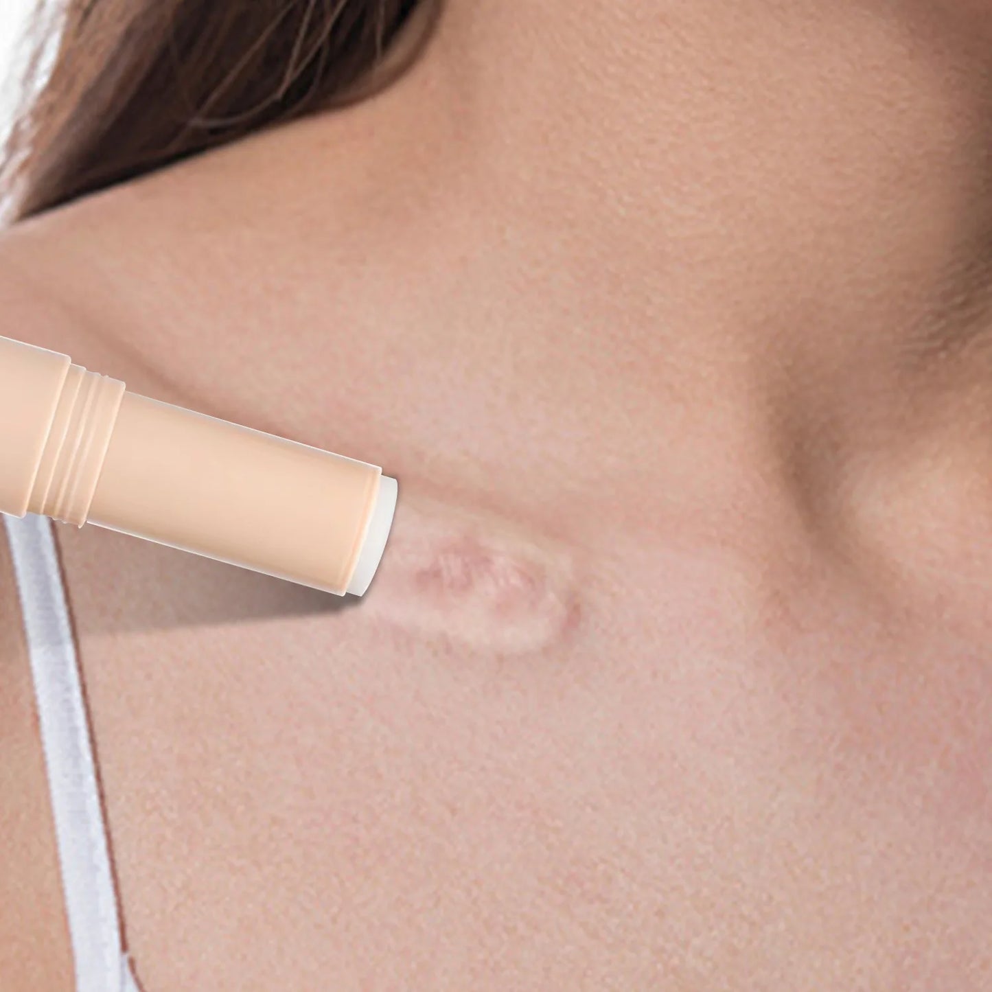Body and Face Silicone Scar Stick