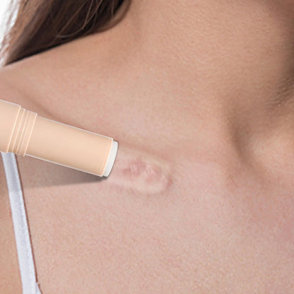 Body and Face Silicone Scar Stick